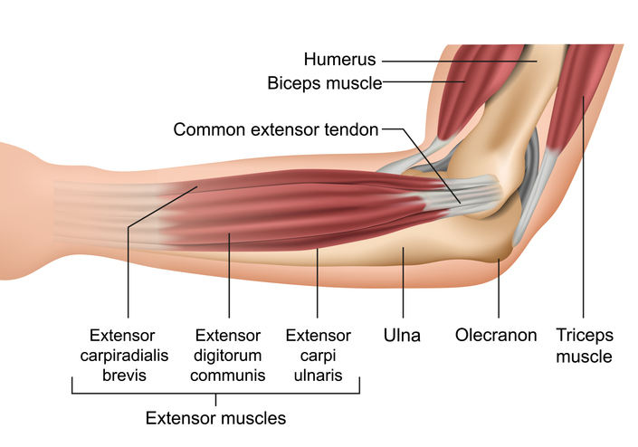 treatment for tennis elbow